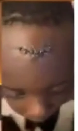 Mother speaks out after son gets hurt in Oyo school