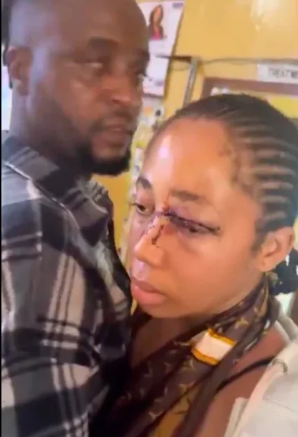 Man Arrested for Assaulting 18-Year-Old in Viral Video