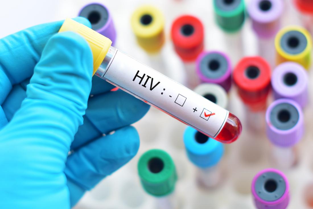 Lagos HIV Numbers Misunderstood, Official Says