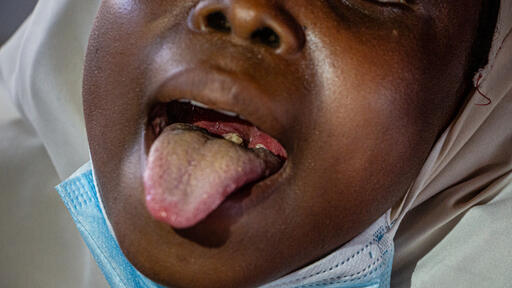 Taraba starts tetanus-diphtheria vaccination for women