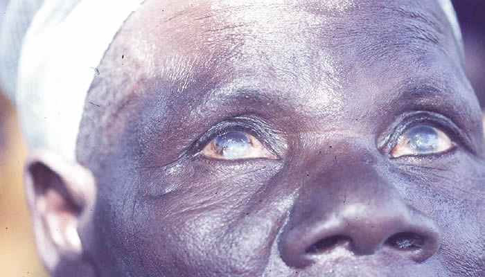 Visually Impaired Nigerians Demand Safer Roads and Job Opportunities