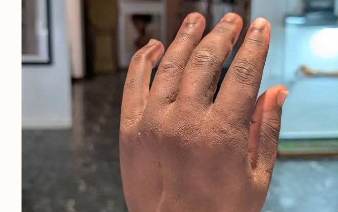 Nigerian Inventor’s Bionic Arm Recognized as One of TIME’s Best Inventions of 2026